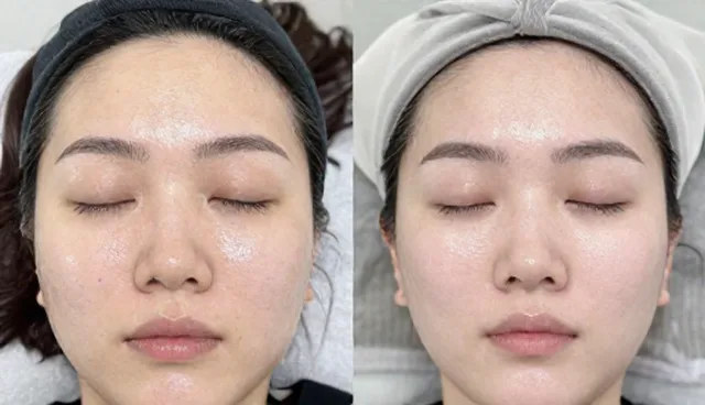 美容清洗设备使用与维护:装饰改装场景的注意事项